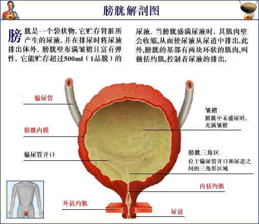 膀胱膨出