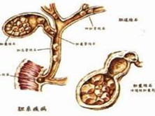 胆系疾病