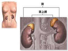 继发性醛固酮增多症