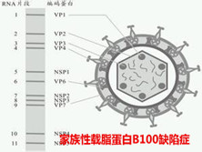 家族性载脂蛋白B100缺陷症