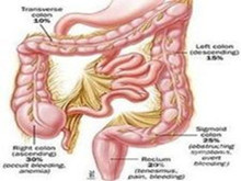 结肠血管畸形