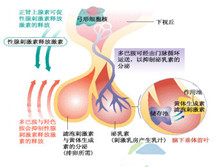 垂体前叶功能减退症