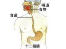 十二指肠炎