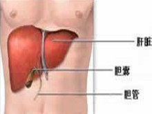 胆管炎