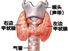 甲状腺功能减退