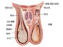 阴囊癌