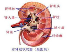 急性肾功能衰竭