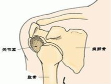 肩关节不稳定