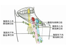 腹股沟淋巴结肿大