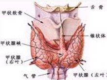 甲状腺瘤