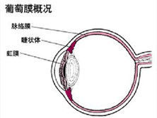 葡萄膜病