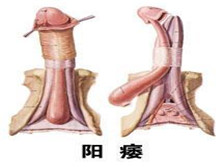 勃起功能障碍