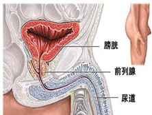 特异性前列腺炎