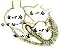 完全性房室传导阻滞