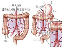 肠系膜上静脉血栓形成