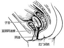 肛门直肠先天性畸形