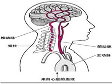 常染色体隐性遗传性脑动脉病及动脉硬化伴皮质下梗死及白质脑病