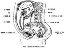 小儿原发性腹膜炎