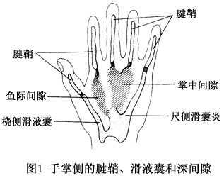 掌侧化脓性腱鞘炎、滑囊炎和深间隙感染