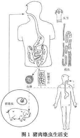 猪带绦虫病