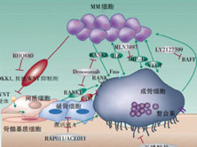 老年多发性骨髓瘤