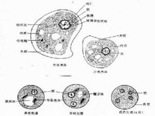 溶组织内阿米巴病