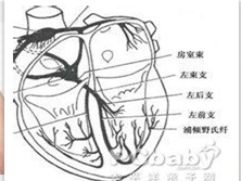 小儿特发性室性心动过速